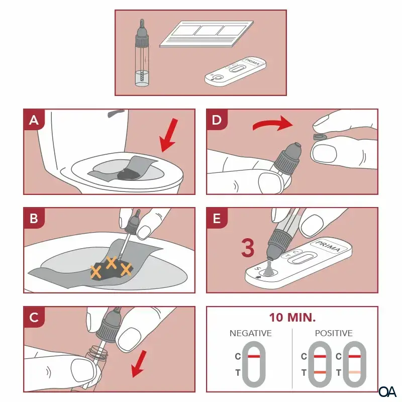 PRIMA® Helicobacter pylori Antigen Home Test