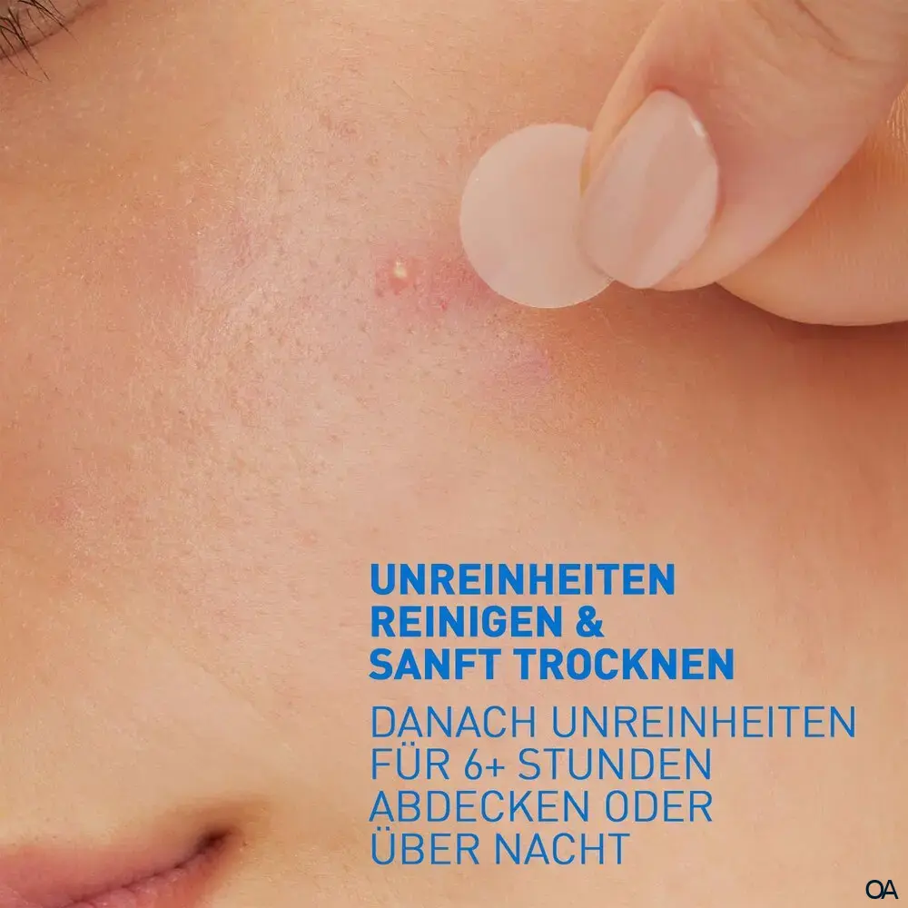 CeraVe Anti-Unreinheiten Patches