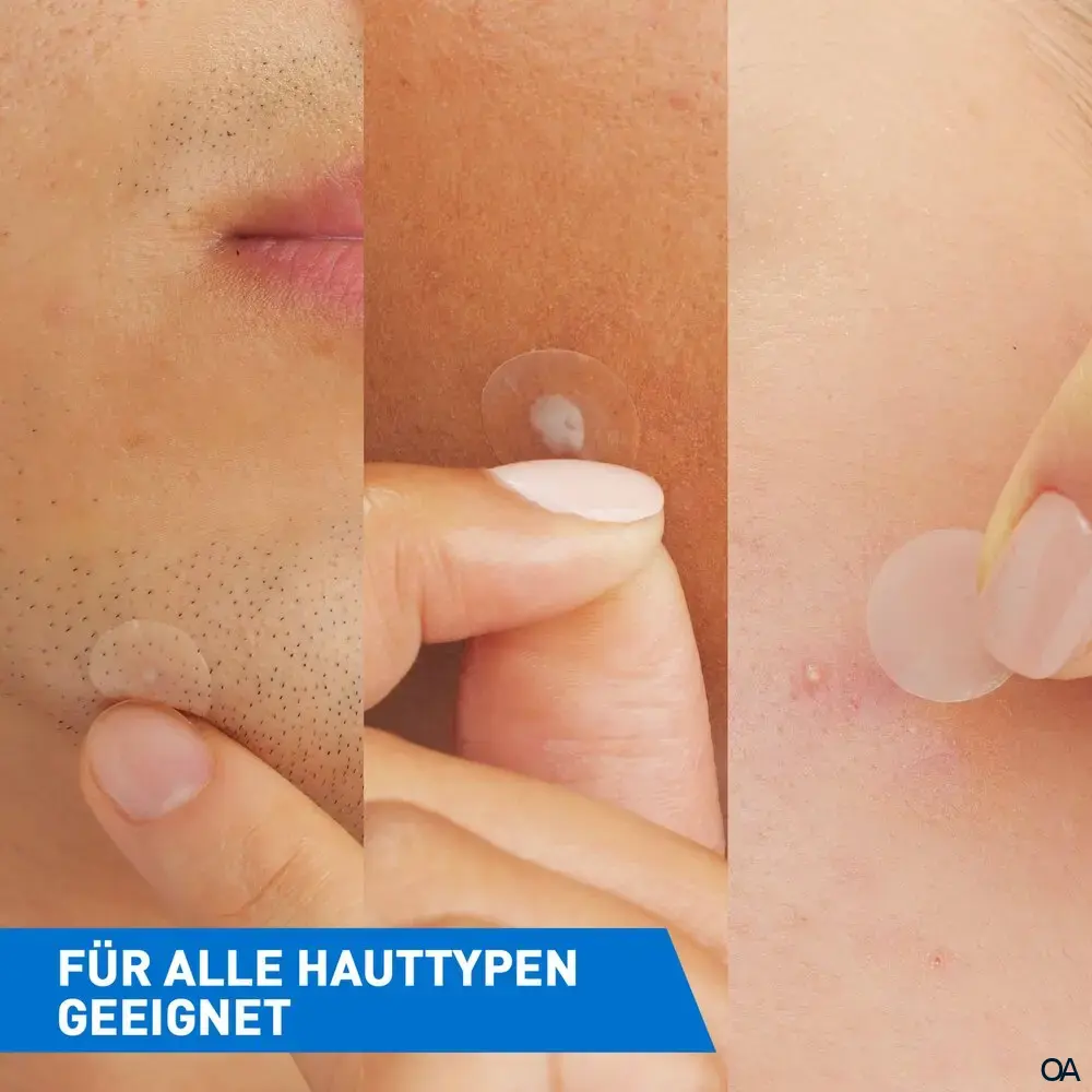 CeraVe Anti-Unreinheiten Patches