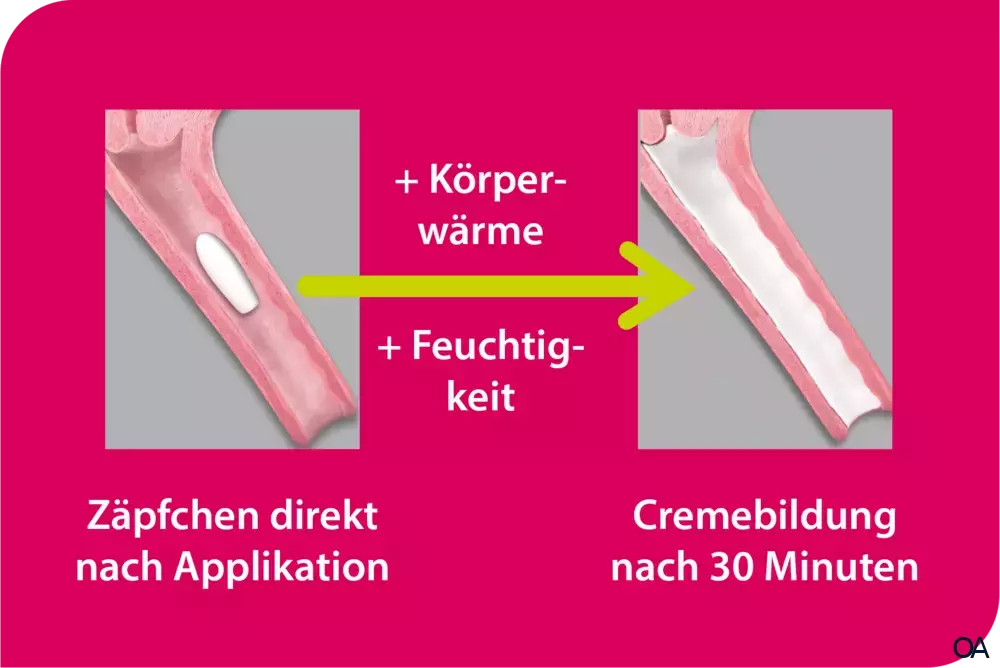 Vagisan FeuchtCreme Cremolum Zäpfchen Vagisan FeuchtCreme Cremolum Zäpfchen