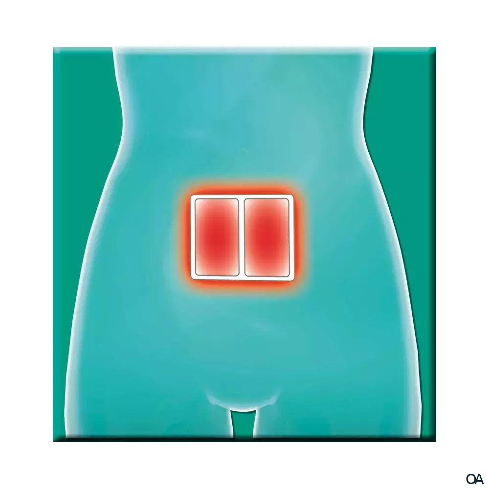 Salus® Gelenk-Aktiv Wärme-Pflaster 13 x 10 cm Salus® Gelenk-Aktiv Wärme-Pflaster 13 x 10 cm