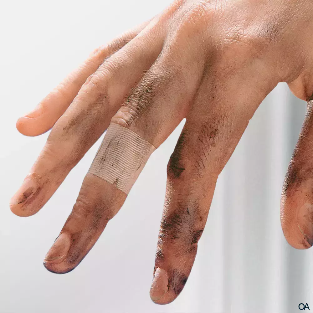 Leukoplast® Barrier Pflaster 3 Größen