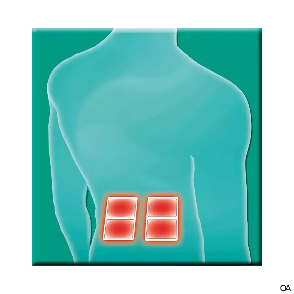 Salus® Gelenk-Aktiv Wärme-Pflaster 13 x 10 cm Salus® Gelenk-Aktiv Wärme-Pflaster 13 x 10 cm