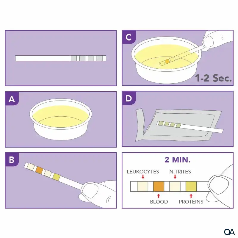 PRIMA® Harnwegsinfektion Home Test