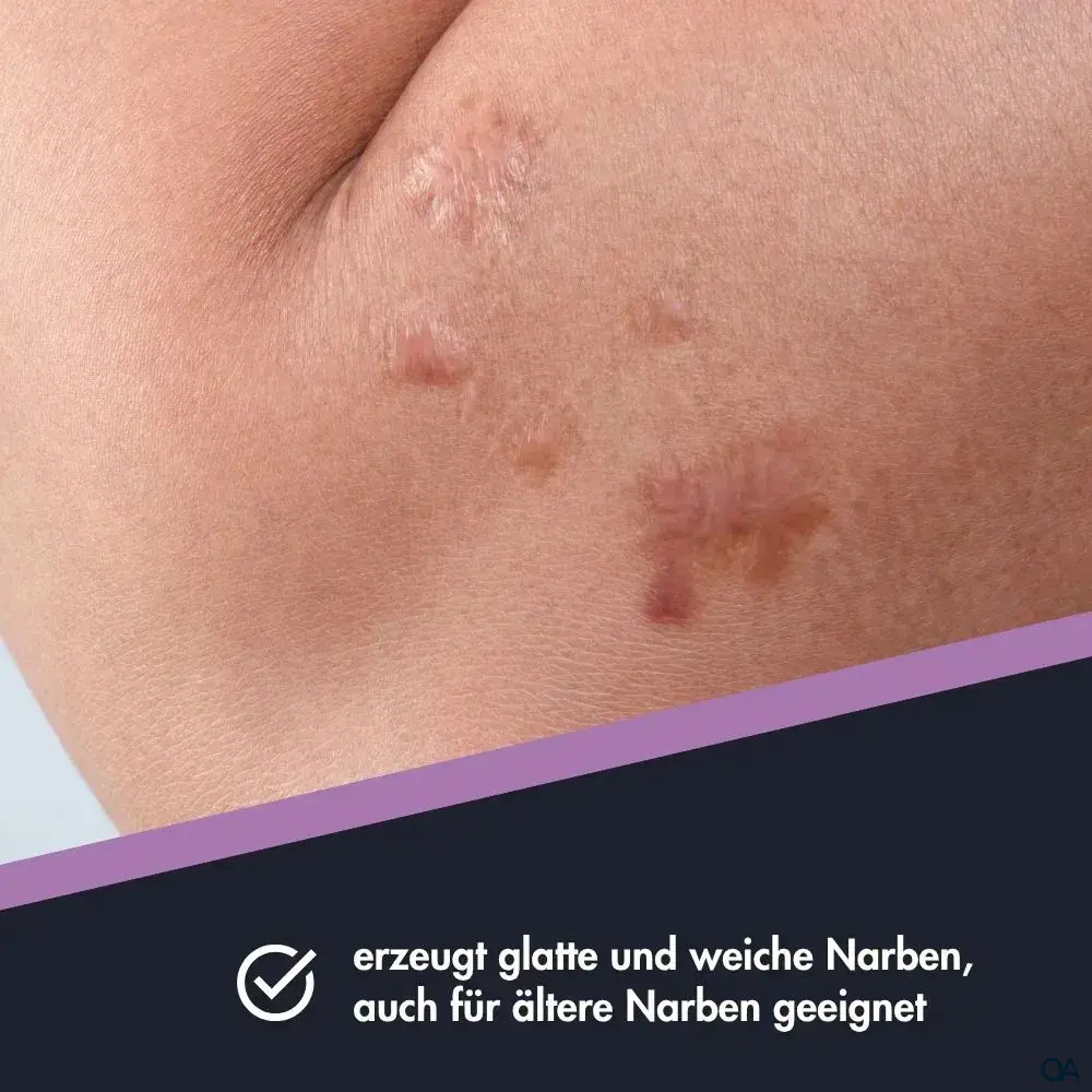 Ensbona® Narbenpflege Salbe