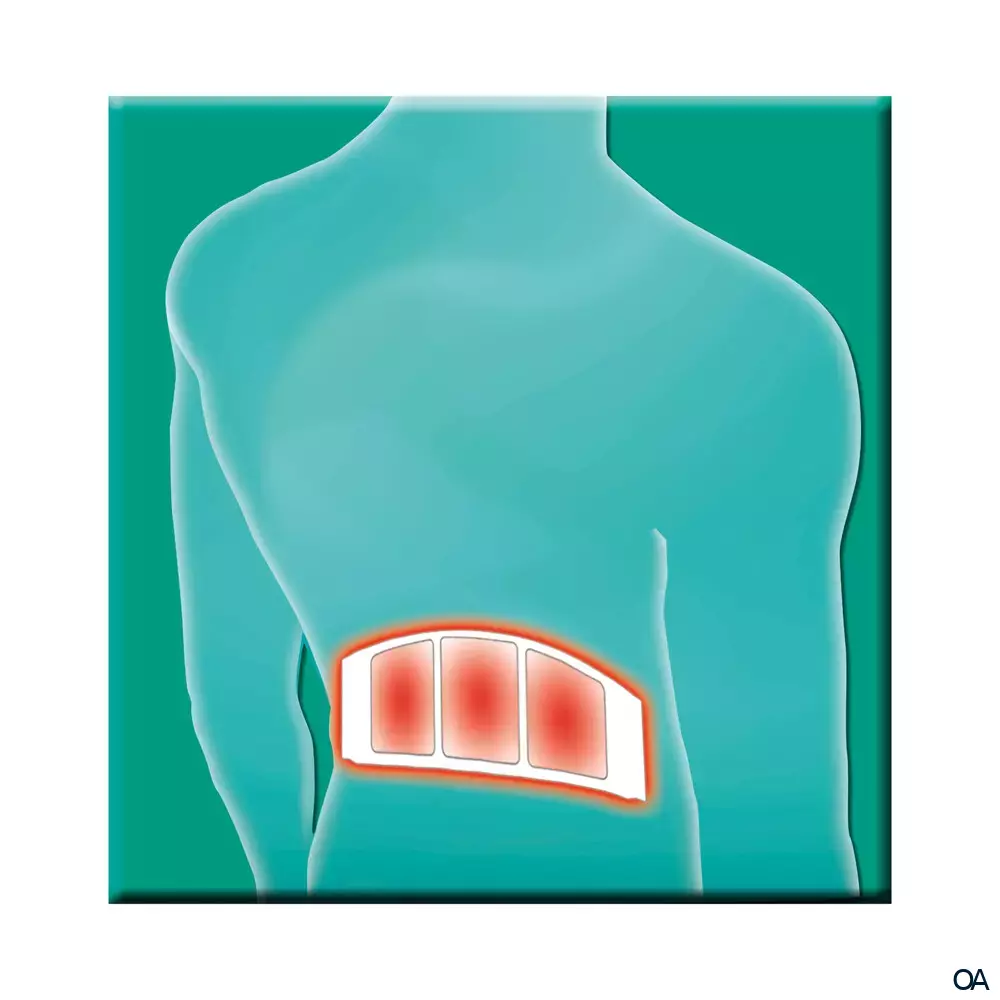 Salus® Gelenk-Aktiv Wärme-Pflaster XL 29 x 9 cm