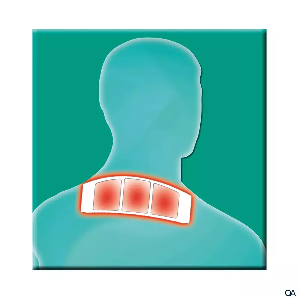 Salus® Gelenk-Aktiv Wärme-Pflaster XL 29 x 9 cm