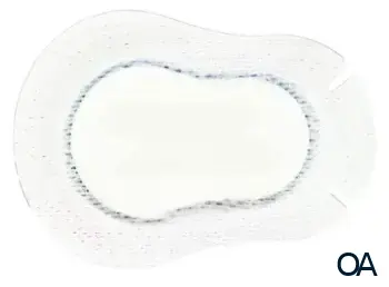 ORTOPAD® Augenokklusionspflaster Weiß Regular 85 x 59 mm ORTOPAD® Augenokklusionspflaster Weiß Regular 85 x 59 mm