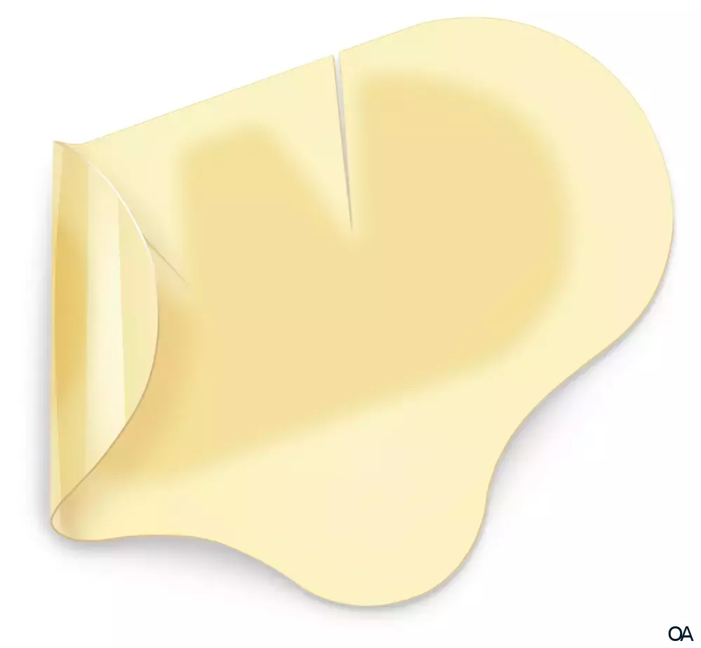 Hydrocoll® Hydrokolloider Wundverband steril, 15 x 15 cm