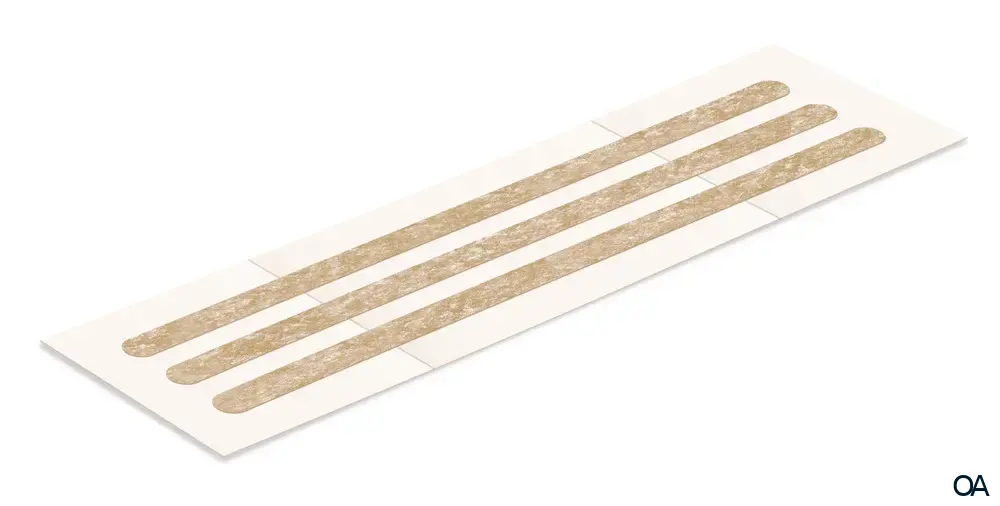 Omnistrip® Wundnahtstreifen steril, 3 x 76 mm