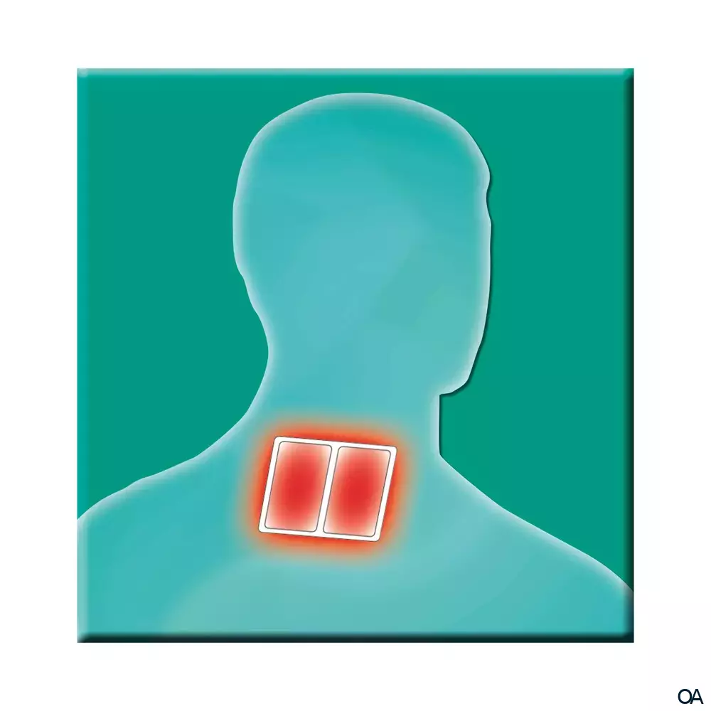 Salus® Gelenk-Aktiv Wärme-Pflaster 13 x 10 cm Salus® Gelenk-Aktiv Wärme-Pflaster 13 x 10 cm